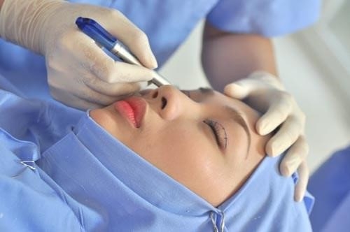  Những yếu tố ảnh hưởng đến thời gian hồi phục của mí