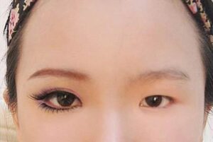 Đôi mắt cân đối do một bên 2 mí một bên một mí