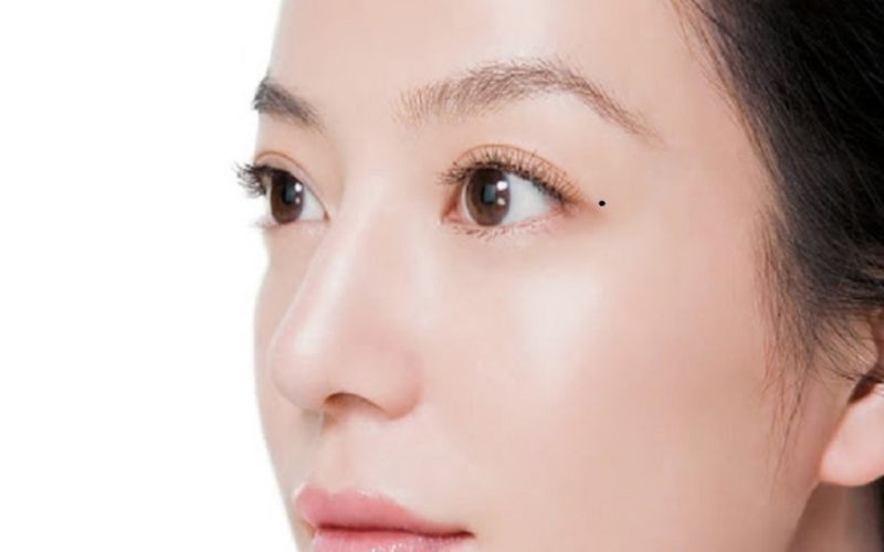 Nốt ruồi ở mí mắt bên trái