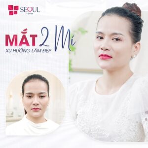 Phương pháp cắt mí Plasma đang là một trong những dịch vụ nổi bật tại Seoul Center Vĩnh Long