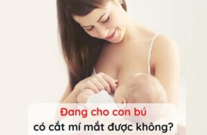 Theo lời khuyên của các bác sĩ, đang cho con bú mẹ KHÔNG nên cắt mí mắt.