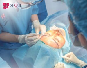 Tái phẫu thuật mí để có được dáng mắt ưng ý