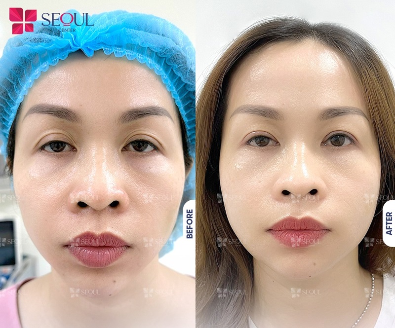 Dáng mắt hài hòa, giúp khuôn mặt đạt tỷ lệ cân đối