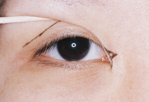 Mở rộng góc mắt trong sẽ loại bỏ da và mở ở khóe mắt giúp đôi mắt to tròn hơn