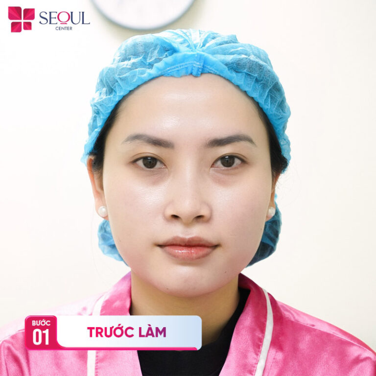 Chuẩn bị tâm lý sẵn sàng và có cơ thể khỏe mạnh trước khi thực hiện nhấn mí