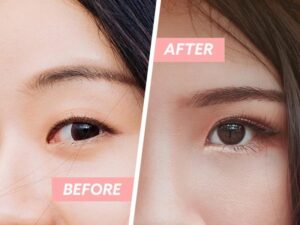 Bên cạnh hiệu quả vượt trội thì miếng dán kích mí vẫn có nhiều tác hại