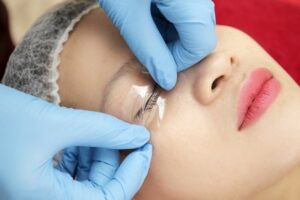 Thuốc gây tê được bôi vào mí mắt có dạng gel hoặc kem