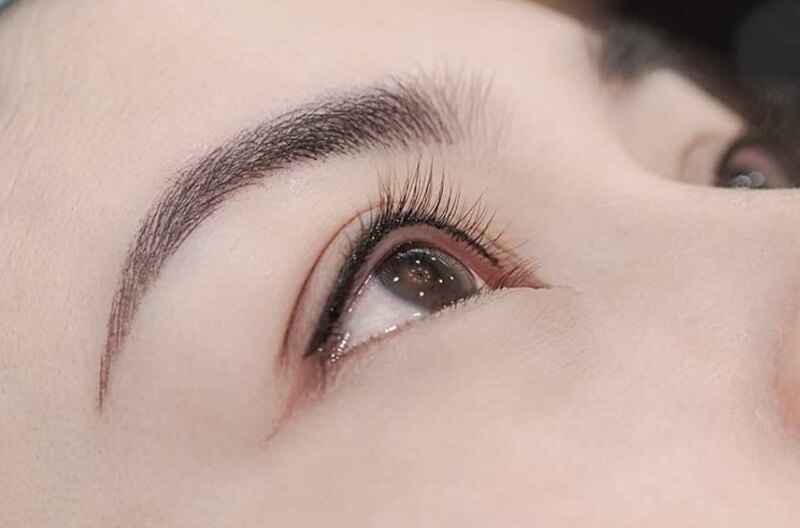 Cắt mí Mini Deep là sự kết hợp hoàn hảo giữa 2 phương pháp bấm mí và cắt mí