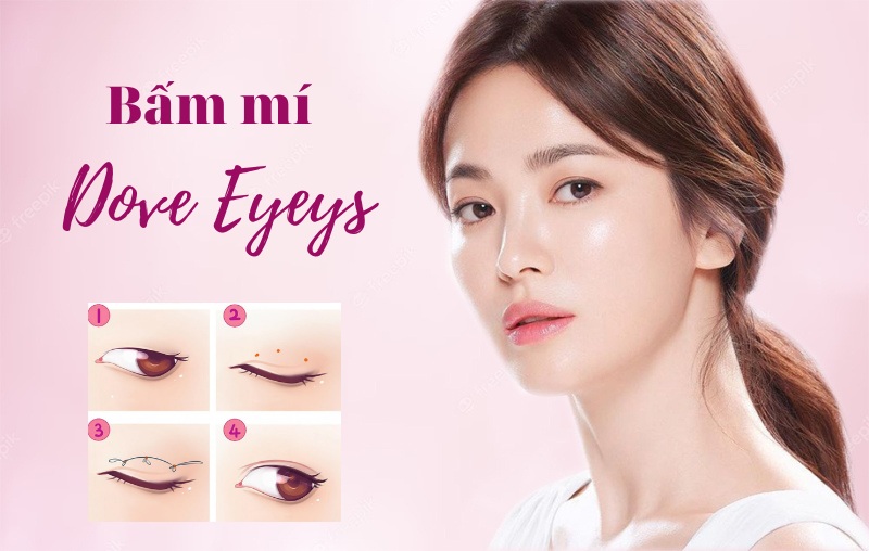 Nhấn mí Dove Eyes là cách hiệu quả để sở hữu đôi mắt bồ câu long lanh Nhấn mí Dove Eyes là cách hiệu quả để sở hữu đôi mắt bồ câu long lanh