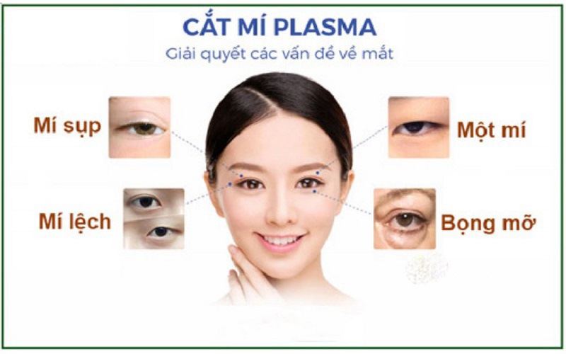 Phương pháp cắt mí Plasma 4 trong 1 mang đến nhiều ưu điểm cho khách hàng