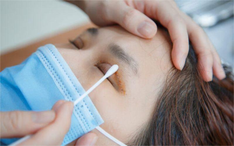 Chăm sóc mí mắt theo hướng dẫn của bác sĩ để mắt nhanh phục hồi Chăm sóc mí mắt theo hướng dẫn của bác sĩ để mắt nhanh phục hồi