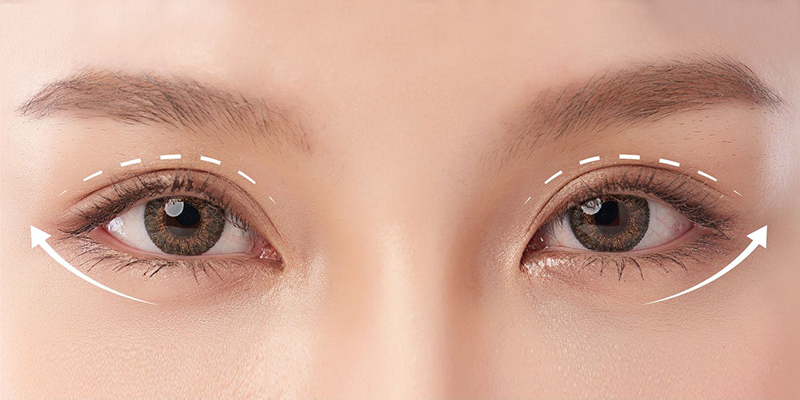 Để tránh rủi ro sau cắt mí cần tìm hiểu và nhận tư vấn chi tiết từ bác sĩ