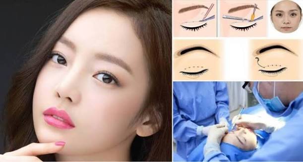 Các thực phẩm như hải sản, rau muống dễ gây mưng mủ sau cắt mí
