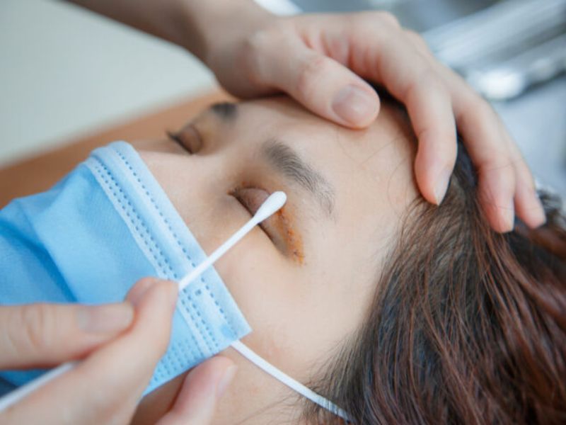 Nên nắm rõ cách vệ sinh mí mắt sau nhấn mí