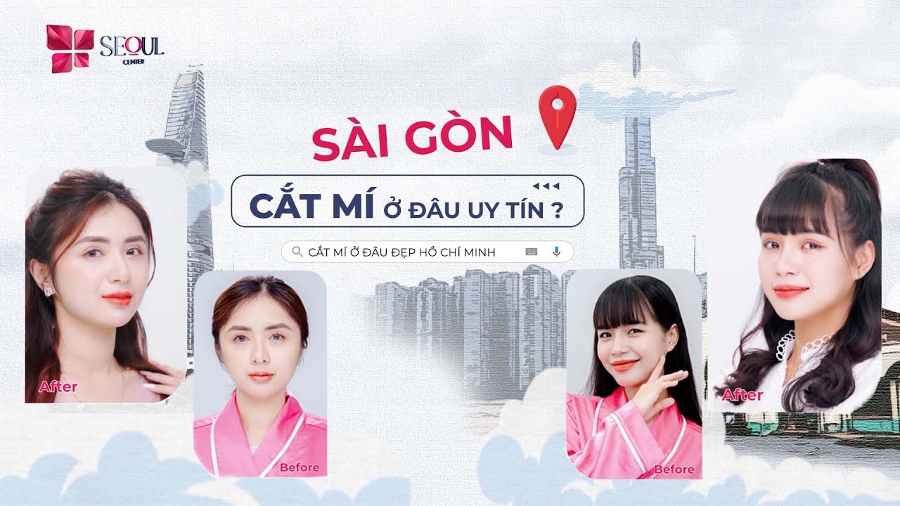Sài Gòn Ở Đâu Cắt Mí Đẹp Tự Nhiên Giúp Đôi Mắt Tươi Trẻ