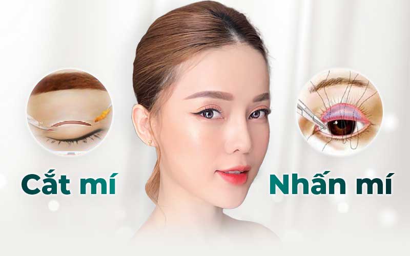 Nên chọn nhấn mí hay cắt mí theo nhu cầu bản thân