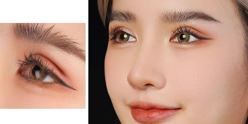 Cần tuân thủ lịch tái khám và chăm sóc theo chỉ dẫn của bác sĩ sau cắt mí