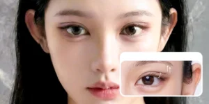 Cắt mí cánh tiên tuy là kỹ thuật khá mới nhưng lại được ưa chuộng