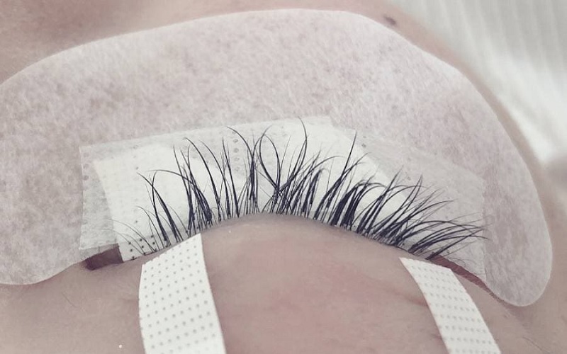 Các bệnh về mắt cũng gây ra tình trạng rụng lông mi