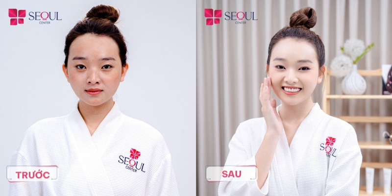 Công nghệ và con người là các yếu tố giúp Seoul Center trở thành địa chỉ tắm trắng tại Hải Phòng được nhiều khách hàng lựa chọn