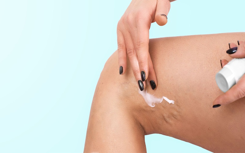 Sử dụng kem ủ tê để hạn chế sự xuất hiện của cơn đau tại vùng da xăm mình