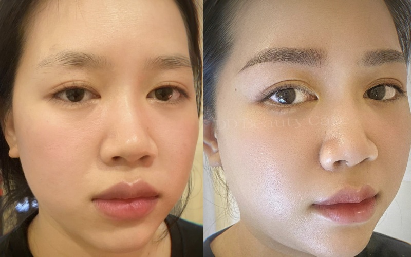 Khách hàng điêu khắc chân mày siêu đẹp ở DD - Beauty Care