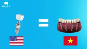 Why is the price at Shark Dental so low?