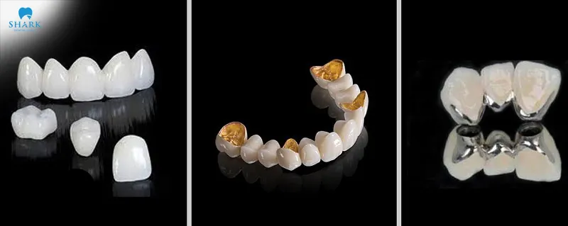 There are many types of porcelain crowns available on the market for customers to choose from