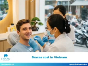 The cost of braces in Vietnam