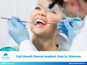 Dental implant cost in Vietnam