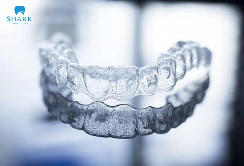 Leetray aligners offer good aesthetics, with no visible signs of braces when smiling or speaking