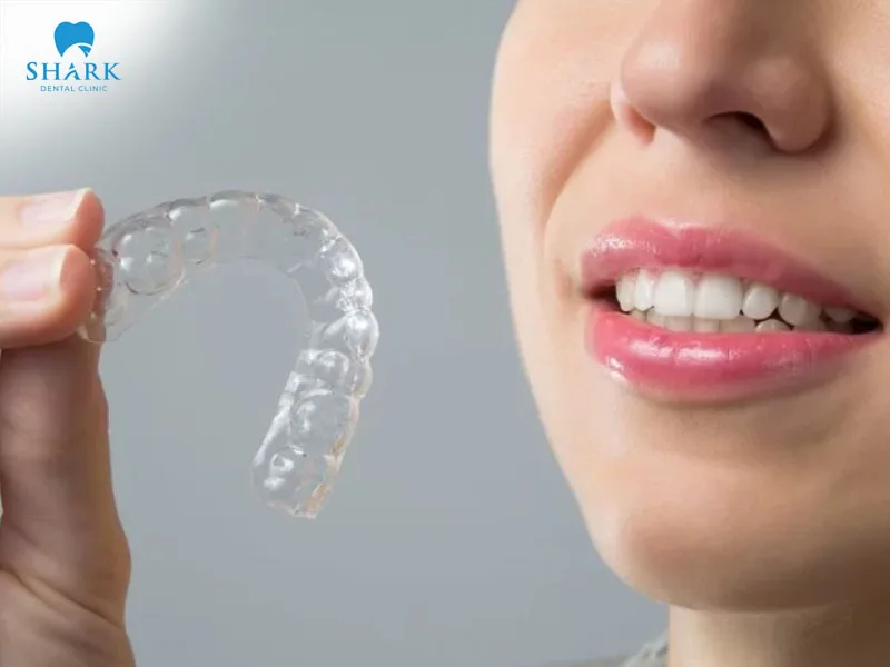 The cost of invisible braces treatment is determined by multiple factors