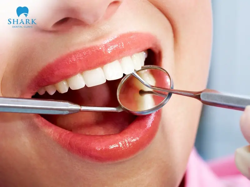 Tooth filling must be performed according to the proper procedure and current dental standards