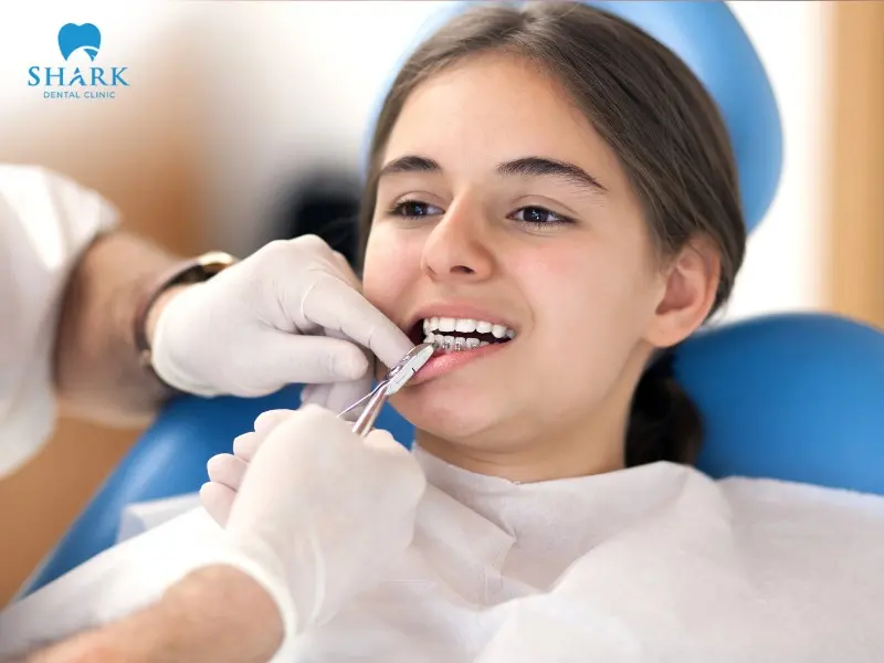 The cost of braces at dental clinics in Vietnam currently ranges from 25M to 130M VND per treatment