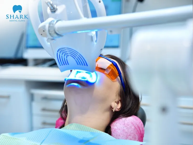 You can choose to whiten your teeth either at a dental clinic or at home, depending on your needs and preferences