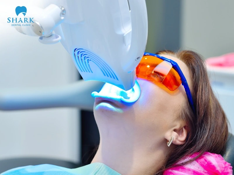 There are many types of dental bleaching in Vietnam for you to choose from