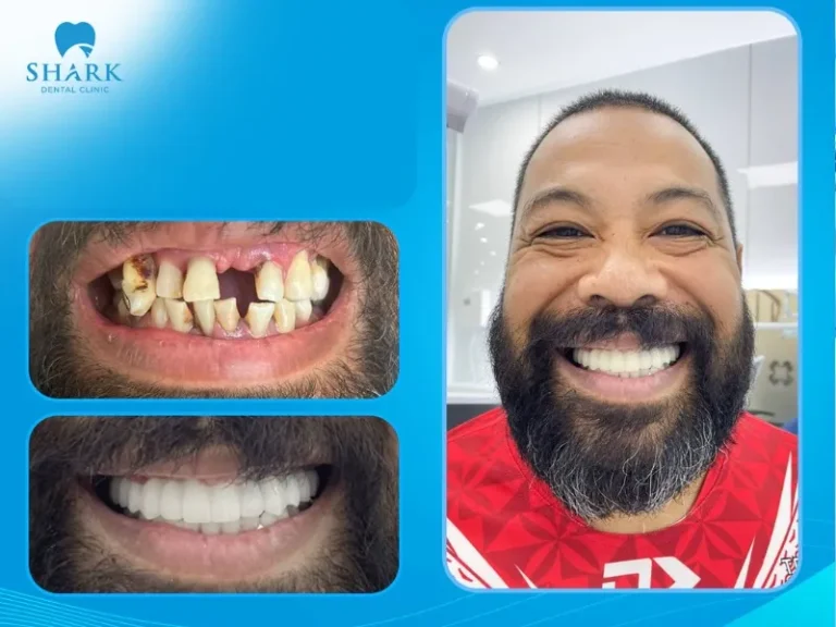 Clients express satisfaction after dental implant treatment