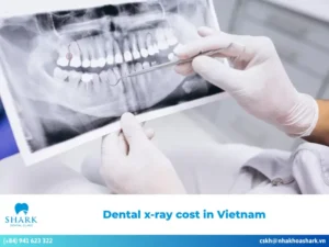 How much does a dental x-ray cost in Vietnam
