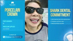 Shark Dental – Born to Create Happy Smiles!