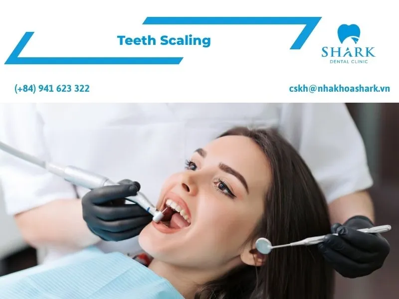 dental scaling