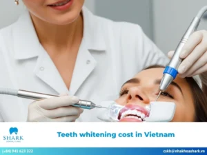 Teeth whitening cost in Vietnam