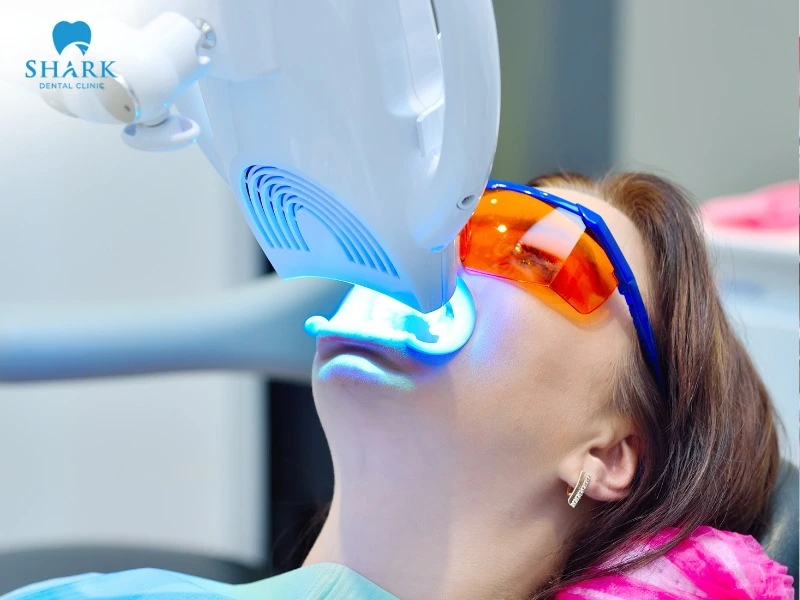 You should consider teeth whitening in Vietnam because it offers affordable costs and high aesthetic effectiveness