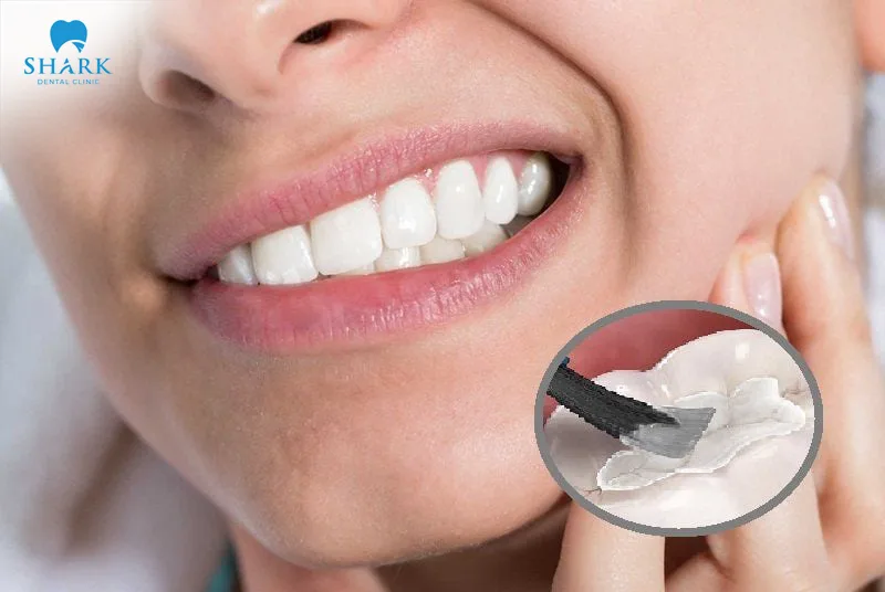 Allergic reaction to filling material or presence of gaps can cause prolonged tooth sensitivity
