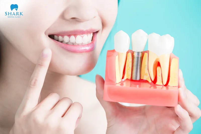 Choose All on X dental implant clinics highly rated by many clients