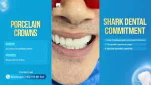 Our latest case - 23 crowns for a total upgraded smile