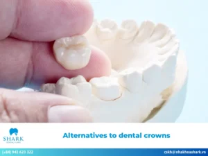 4 alternatives to dental crowns