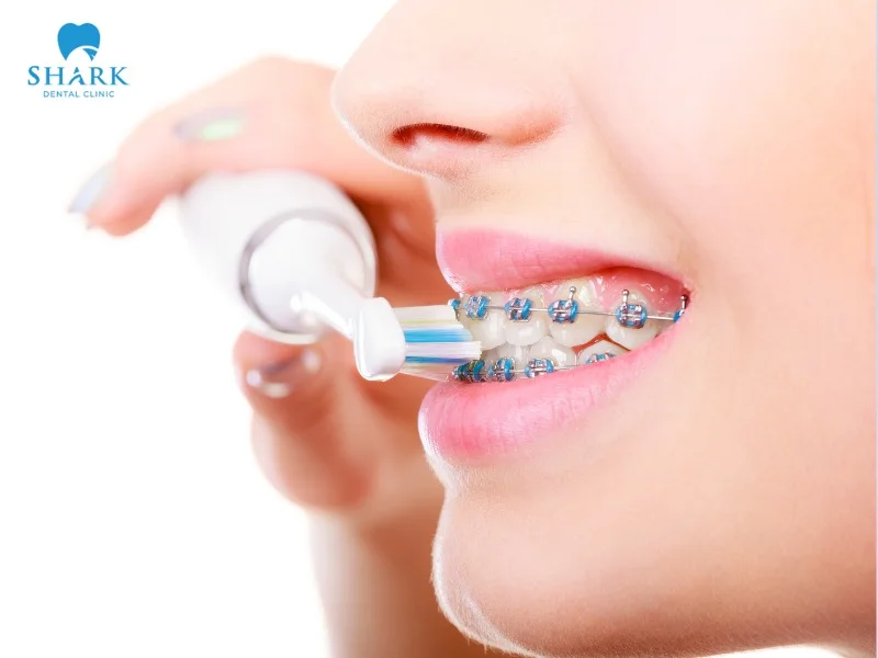 You need to pay close attention to oral hygiene after chewing gum