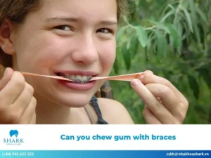 Can you chew gum with braces