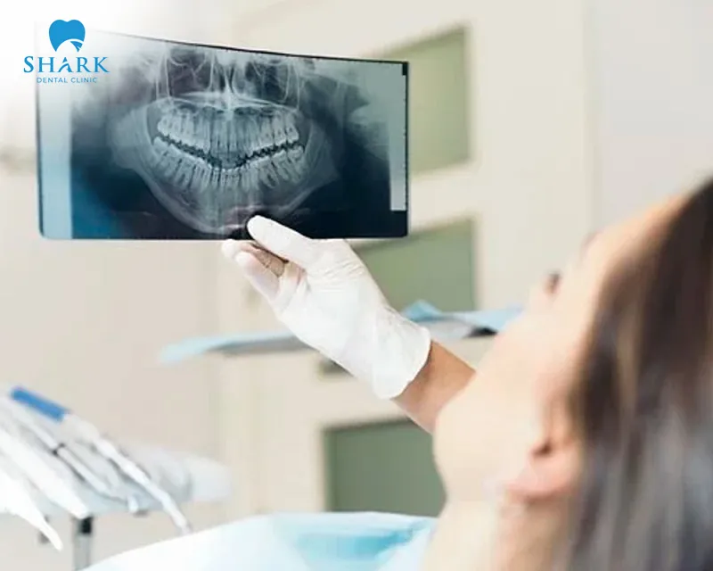 Dental X-rays provide accurate and safe results