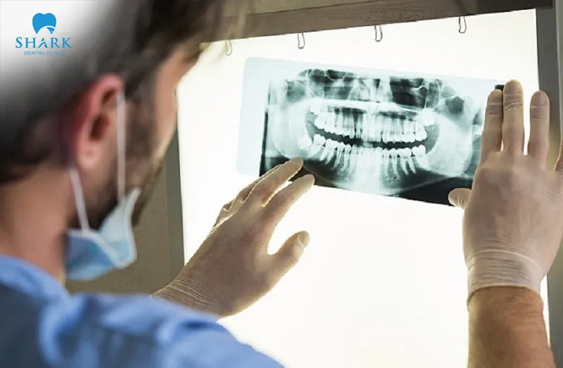 The dentist will provide guidance on safety standards during dental X-ray procedures